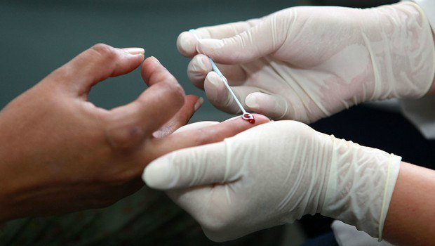 Certificação será entregue no Dia Mundial de Luta Contra a AidsFoto: Divulgação