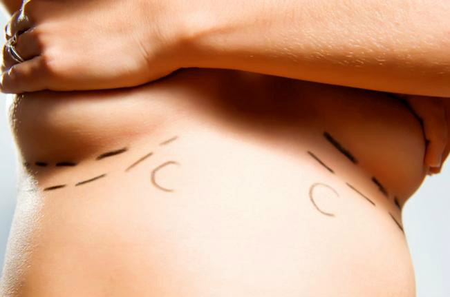Anvisa recomenda exames a mulheres com próteses da marca PIP Anvisa recomenda exames a mulheres com próteses da marca PIP