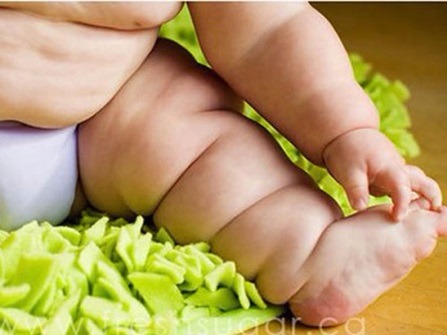 3 de Junho - Dia da Conscientização Contra a Obesidade Mórbida Infantil Foto: Divulgação