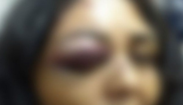 Jovem é agredida em Ponta Porã, por ex que não aceita fim de relacionamento Foto: Ilustrativa