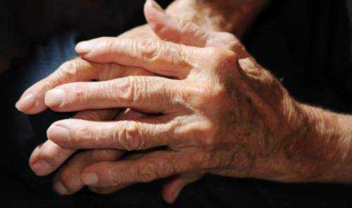 Genes poderão ajudar no tratamento e prevenção da artrite