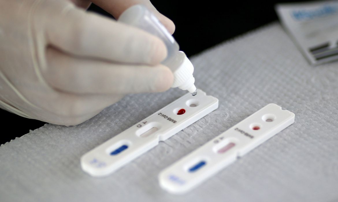 Pesquisadores desenvolvem testes rápidos para detectar coronavírus © Reuters/Ueslei Marcelino/Direitos Reservados
