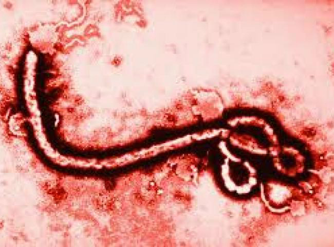 Cientistas portugueses descobrem especificidades genéticas do vírus ebola