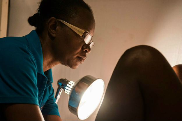 Países mais pobres do mundo têm oito entre 10 casos de câncer cervical