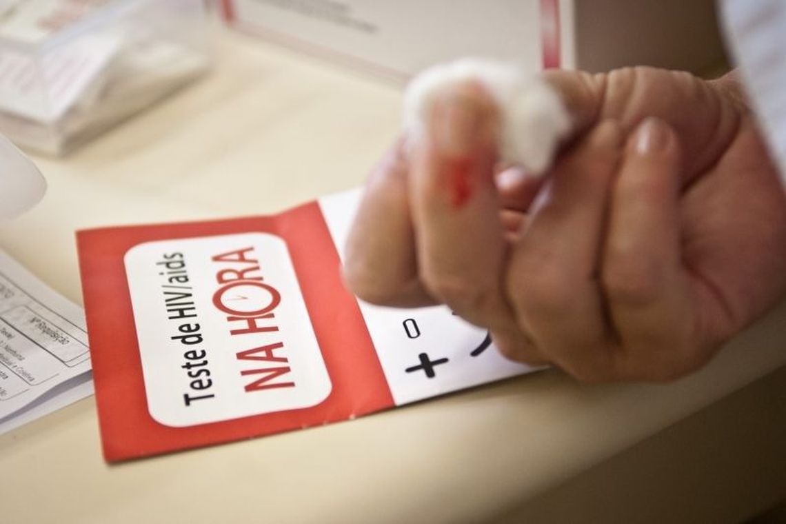 Tempo de vida de pessoas com HIV mais que dobra no Brasil Arquivo/Agência Brasil