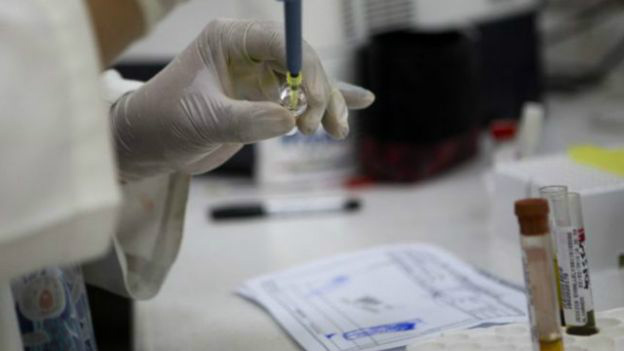 Butantan cobra verbas e diz que em três anos pode ter vacina contra zika BBC Brasil – Há uma grande cobrança da sociedade brasileira sobre a busca pela vacina contra o zika, e o mundo está em alerta. Na sua opinião, o que emperra a liberação dos recursos necessários, apesar da situação emergencial?