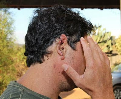 Pai abraça filho, é chamado de gay e tem orelha cortada