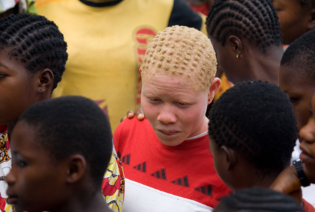 Ikponwosa Ero visitou Moçambique em setembro de 2017 para analisar situação dos albinos. Foto: ONU/Marie Frechon