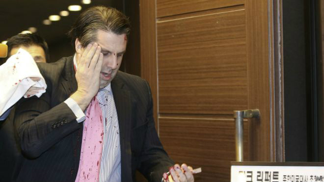 Embaixador norte-americano Mark Lippert ferido com uma faca por assaltante disse que o ocorrido tem como objetivo ferir a aliança entre Seul e Washington / Foto: Divulgação
