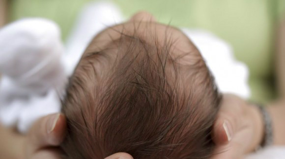 Associação espírita é contra aborto em casos de microcefalia Associação espírita é contra aborto em casos de microcefalia