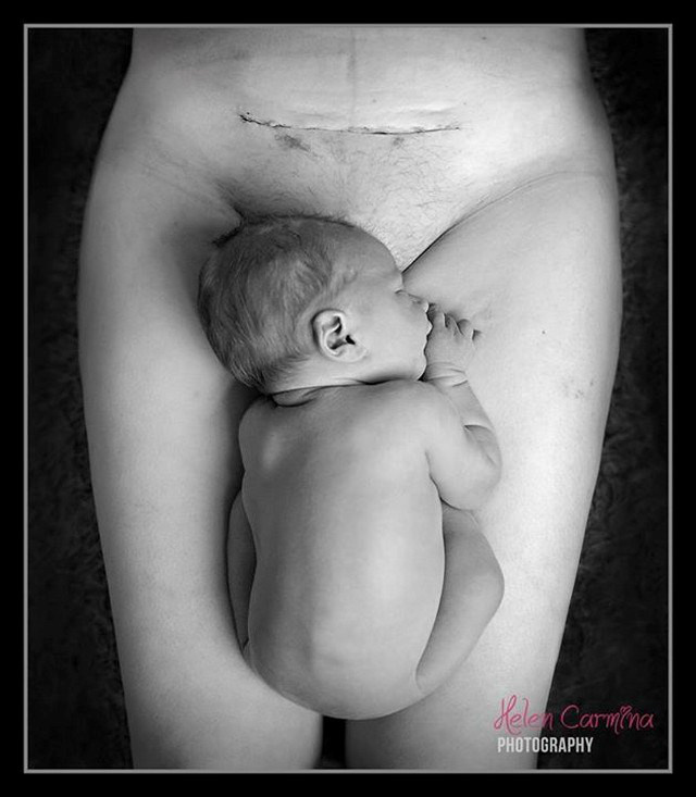 A polêmica por trás da foto de uma mãe com seu filho recém-nascido