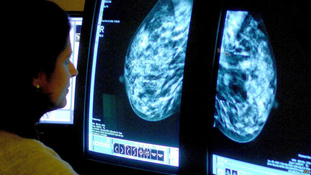 Segundo OMS, câncer de mama já é o tipo mais comum de câncer em mulheres em 140 países