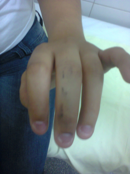 Os dedos da menina, ainda manchados da graxa do coturno do PM que estava fardado.