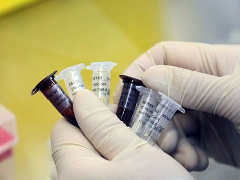 Chile registra 11 mortes por gripe A (H1N1)