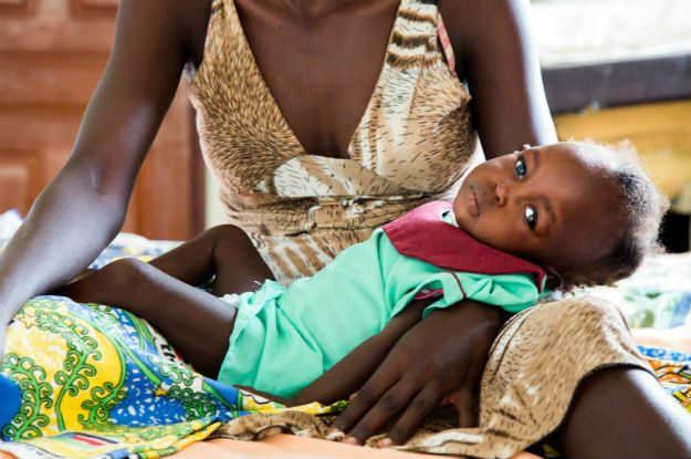 Criança com desnutrição severa em Juba, no Sudão do SulFoto: Divulgação