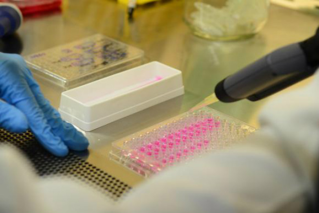 Professor da UFF testa vacinas contra infecção hospitalar causada por bactérias A Staphylococcus aureus é uma bactéria encontrada na pele e nas fossas nasais de pessoas saudáveis, mas que pode provocar desde infecções simples até doenças graves, entre elas pneumonia, meningite, endocardite e infecção generalizada / Foto: Rovena Rosa