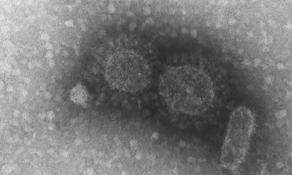 Brasil registra 570 casos de infecção pela variante Delta Foto:Divulgação