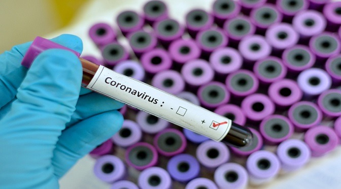 Covid-19: mais 1 caso confirmado em Amambai; número de infectados agora é 147 Foto: Divulgação