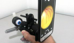 O SRC consiste em um conjunto ótico e eletrônico que, acoplado a um smartphone de boa qualidade, permite obter imagens de alta resolução do fundo do olho / Foto: USP Divulgação 