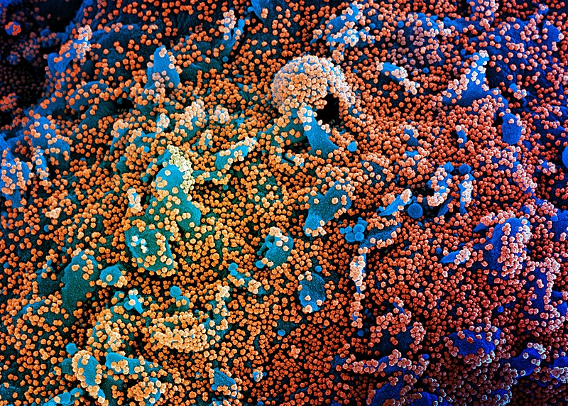 Imagem eletrônica de célula fortemente infectada com partículas do vírus SARS-COV-2, isolada de uma amostra de paciente. - NIAID Integrated Research Facility (IRF) em Fort Detrick, Maryland/ Fotos Públicas
