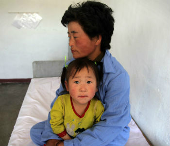 Mulher e criança no hospital pediátrico em Hamhung, na Coreia do Norte. Foto: Ocha/David Ohana (arquivo)