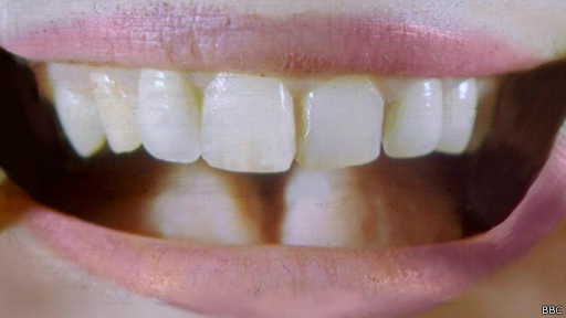 Dente recriado na China é rudimentar e menos rígido que o dente humano natural