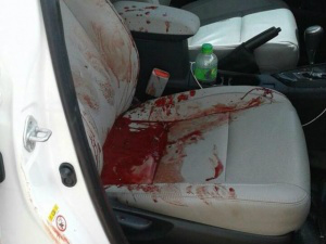 Morre paraguaio ferido a tiros por pistoleiros brasileiros em Pedro Juan Cidadão paraguaio foi atingido dentro de táxi e morreu no hospital (Foto: Direto das Ruas)