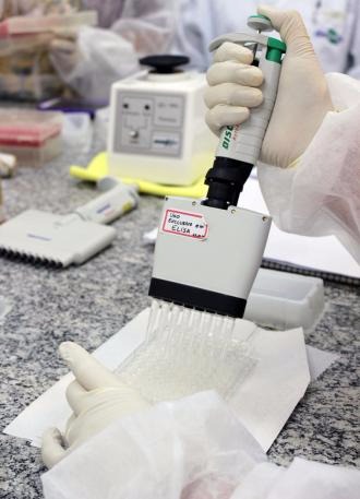 Assinatura de contrato dá novo rumo às pesquisas em tuberculose bovina O kit em desenvolvimento fornece informações adicionais aos métodos tradicionais de detecção da doença.