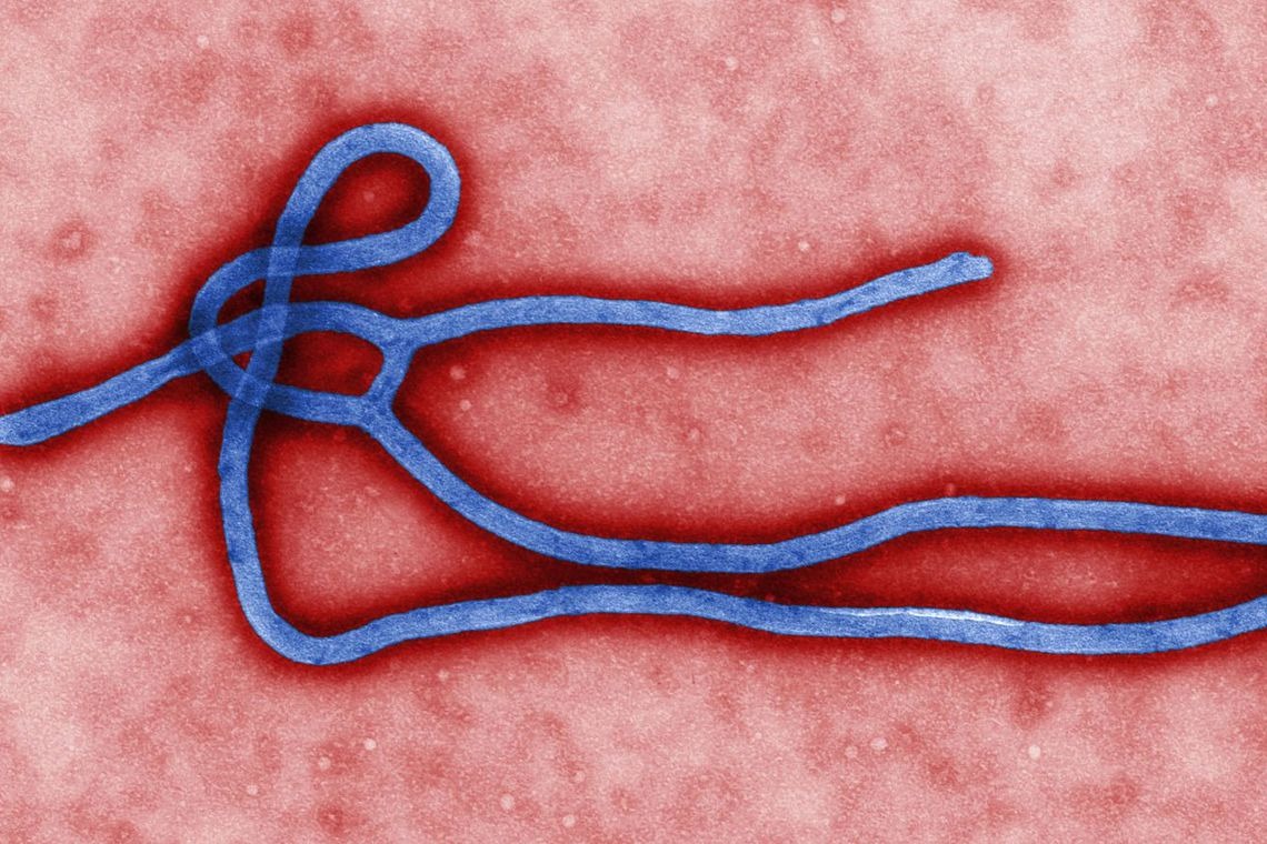 Vírus ebola é importado por laboratório em Tóquio para pesquisa microbiologist Cynthia Goldsmith