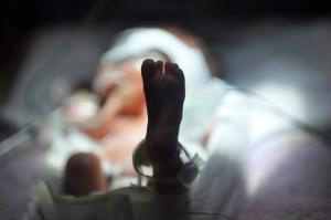 Quase 12% dos partos feitos no Brasil são prematuros O Brasil está na décima posição entre os países onde mais nascem prematuros (miss.libertine/flickr/Creative Commons)