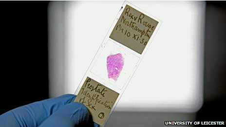 Cientistas colheram amostras de DNA a partir de tecido de próstata da vítima