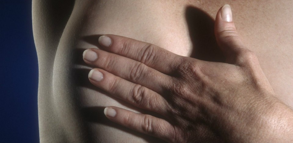 A doença é causada pela multiplicação de células anormais da mama.