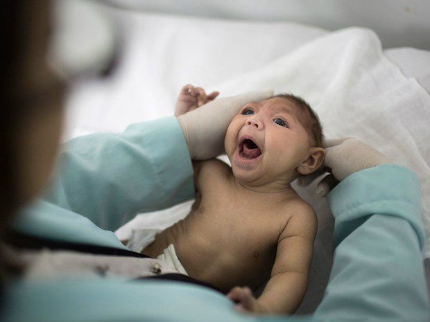 Saúde: 1.198 casos de microcefalia são confirmados no país Saúde confirma 1.198 casos de microcefalia no país