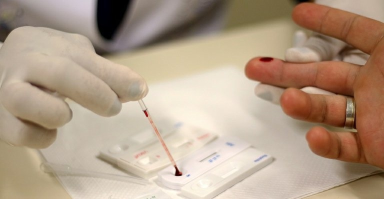 Unidades de saúde oferecem teste de detecção da hepatite C 