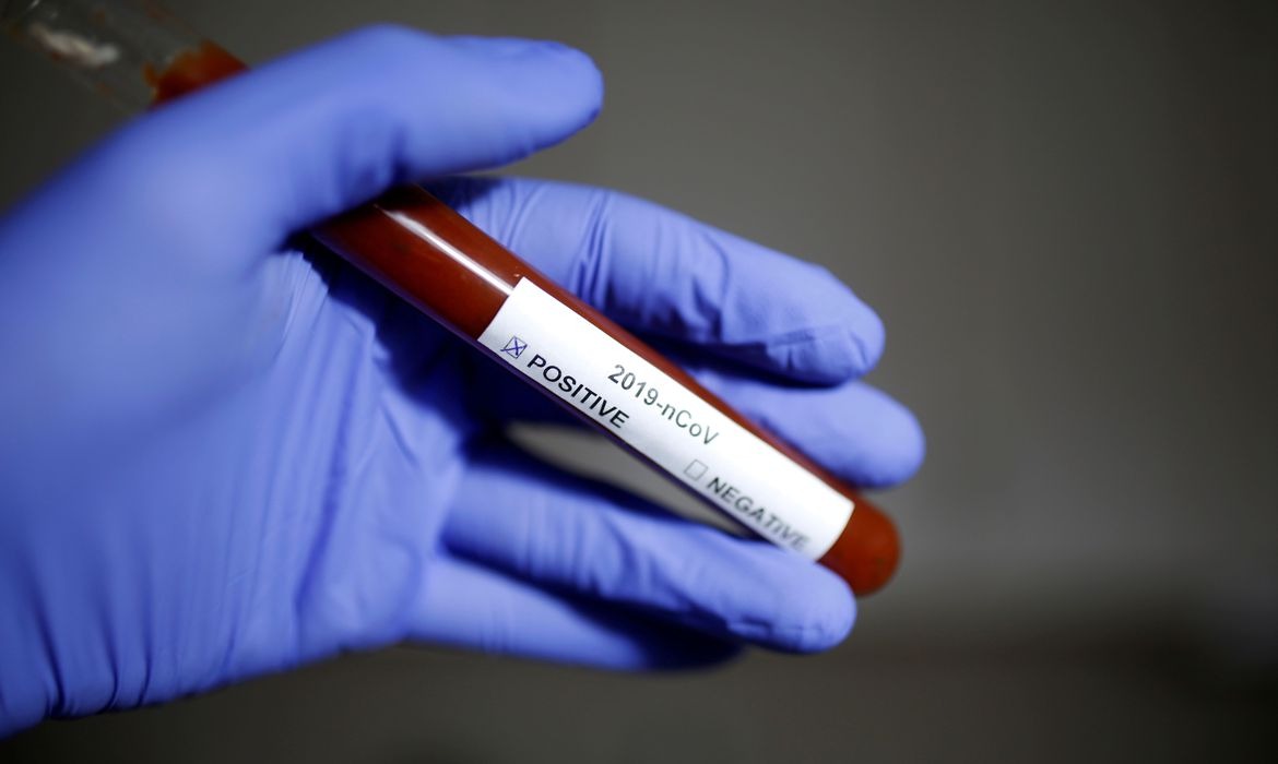 Foto: Dado Ruvik/Reuters