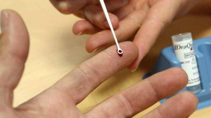 Novo exame para Hepatite C será ofertado pelo SUS Novo exame para Hepatite C será ofertado pelo SUS