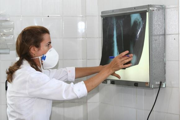 É necessário ficar atento aos sintomas da tuberculose para dar início ao tratamento e, com isso, interromper a contaminação das outras pessoasAgecom Bahia