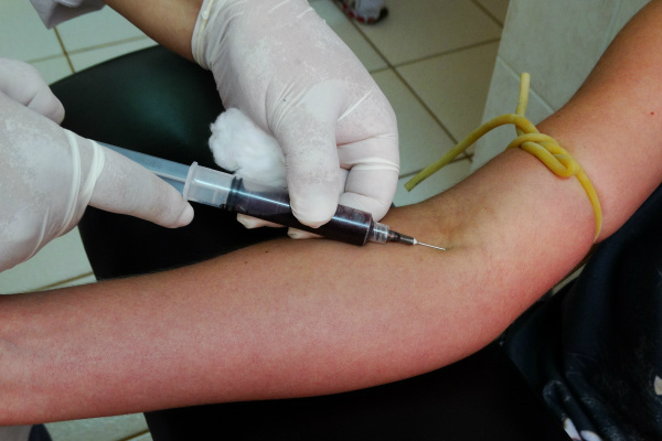 Dengue coloca Amambai em 7º lugar em casos registrados Coleta de sangue para sorologia de Dengue. Para que o diagnóstico seja cem por cento eficaz e entre nas estatísticas oficiais dos órgãos governamentais, as analises do material coletado tem que passar pelo Lacen. / Foto: Vilson Nascimento