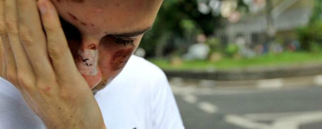Mais um casal gay é agredido em São Paulo Mais um casal gay é agredido em São Paulo