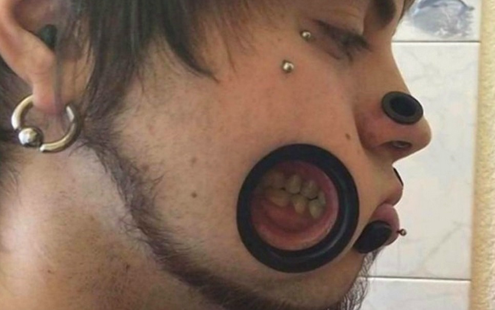 Esburacado radical: jovem leva o uso de alargadores ao extremo Esburacado radical: jovem leva o uso de alargadores ao extremo