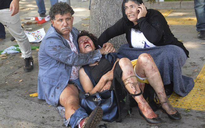 Número de mortos em explosão na Turquia sobe para 86
