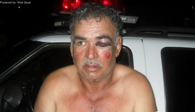 Foto: Fronteira AgoraCarmo teria sido agredido e amarrado por populares até a chegada da PM