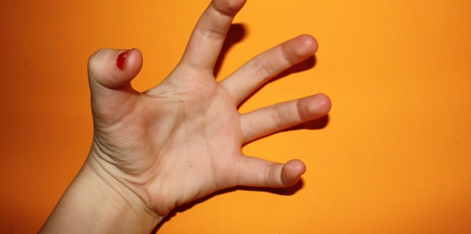 Para que servem as linhas das palmas de nossas mãos? Foto: Divulgação