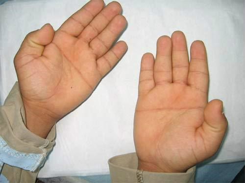 Para que servem as linhas das palmas de nossas mãos? Foto: Divulgação
