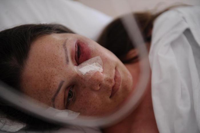 Motorista cai em cratera na cidade de Flores da Cunha Vanessa Cavagnoli, 35, contou que voltava de Caxias com a filha Andressa Carnizella, 12, no banco da carona / Foto: Antonio Valiente / Agencia RBS