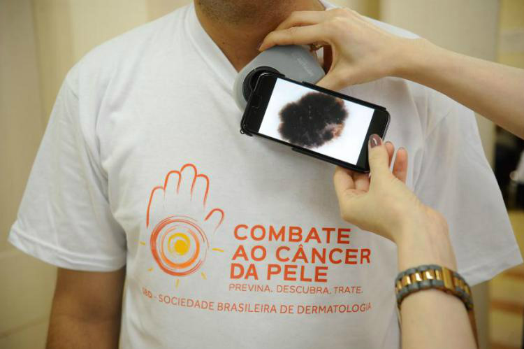 O Dia Nacional de Combate ao Câncer de Pele é lembrado em 26 de novembroFoto: Divulgação