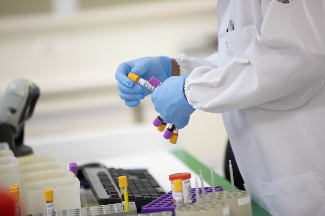 Teresópolis registra segundo caso de meningite bacteriana em 2019 Governo do Estado de São Paulo