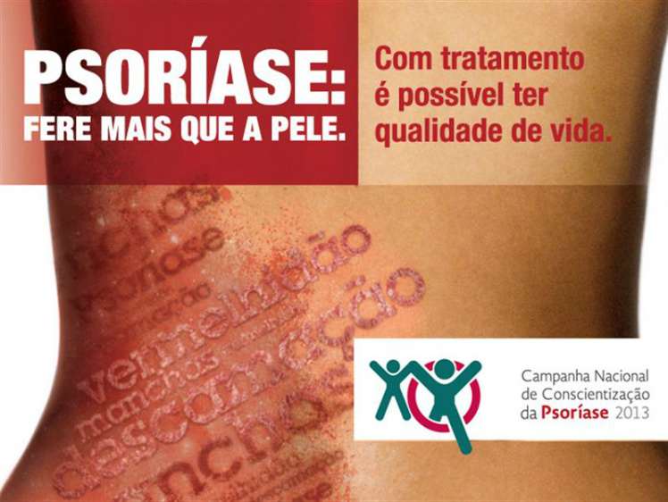 29 de outubro, Dia Mundial de conscientização da Psoríase