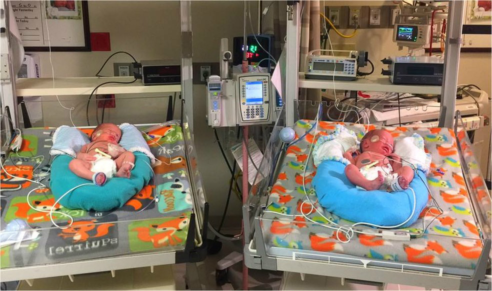 Gêmeos nascem com intervalo de dois minutos em anos diferentes nos EUA Gêmeos nasceram com um intervalo de apenas dois minutos (Foto: Davis Hospital and Medical Center/Facebook)