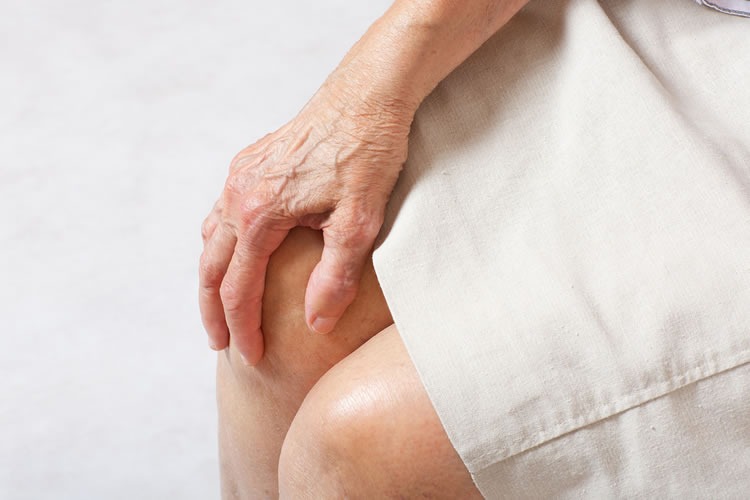 Osteoporose: Por que a menopausa tem relação com a doença?